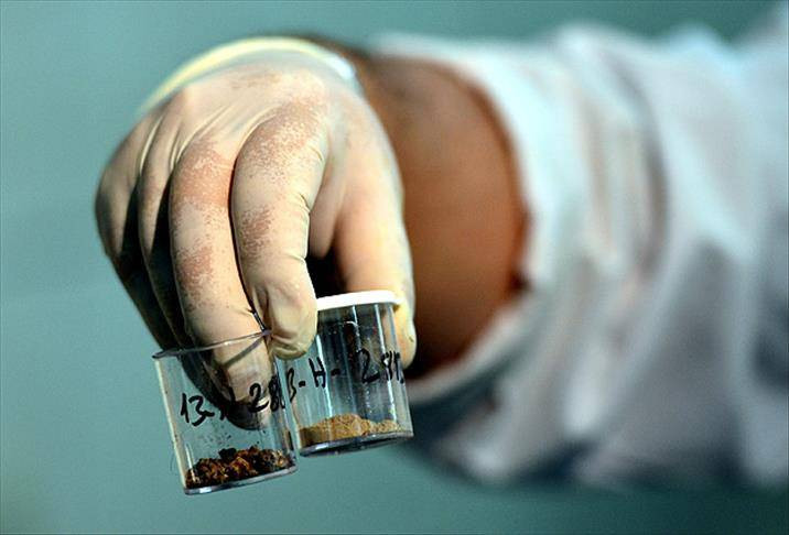 Havalar ısındı böbrek taşına dikkat! Uzman isim uyardı - Resim: 5